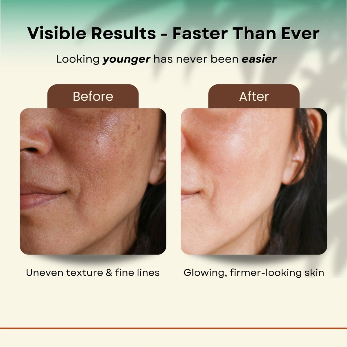 Auréa™ Facial Sculptor