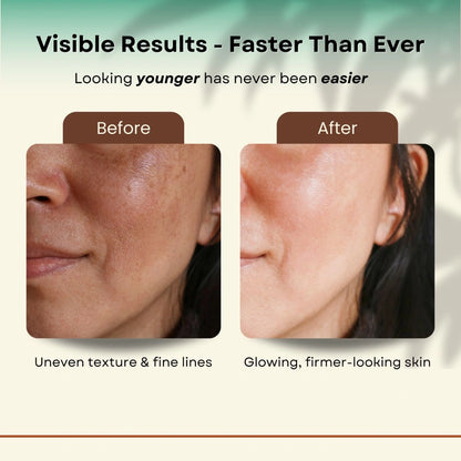 Auréa™ Facial Sculptor